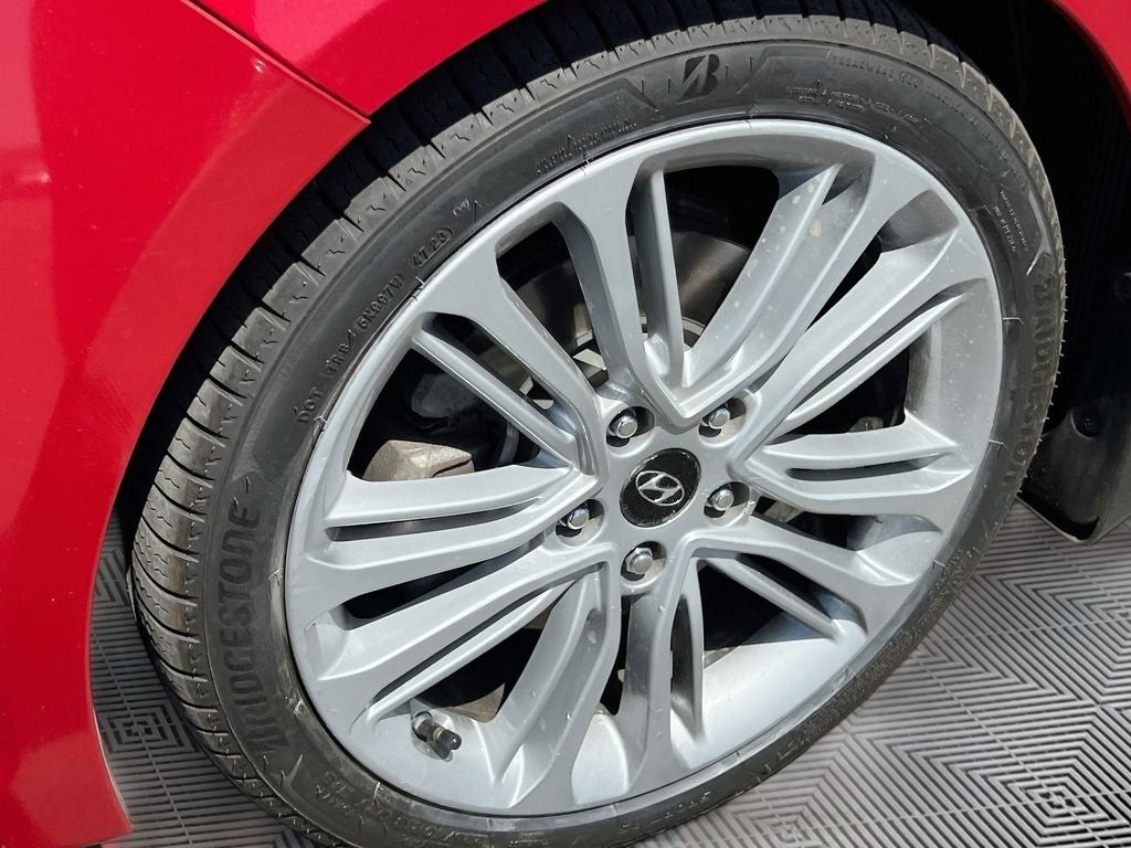 2016 Hyundai Veloster Turbo